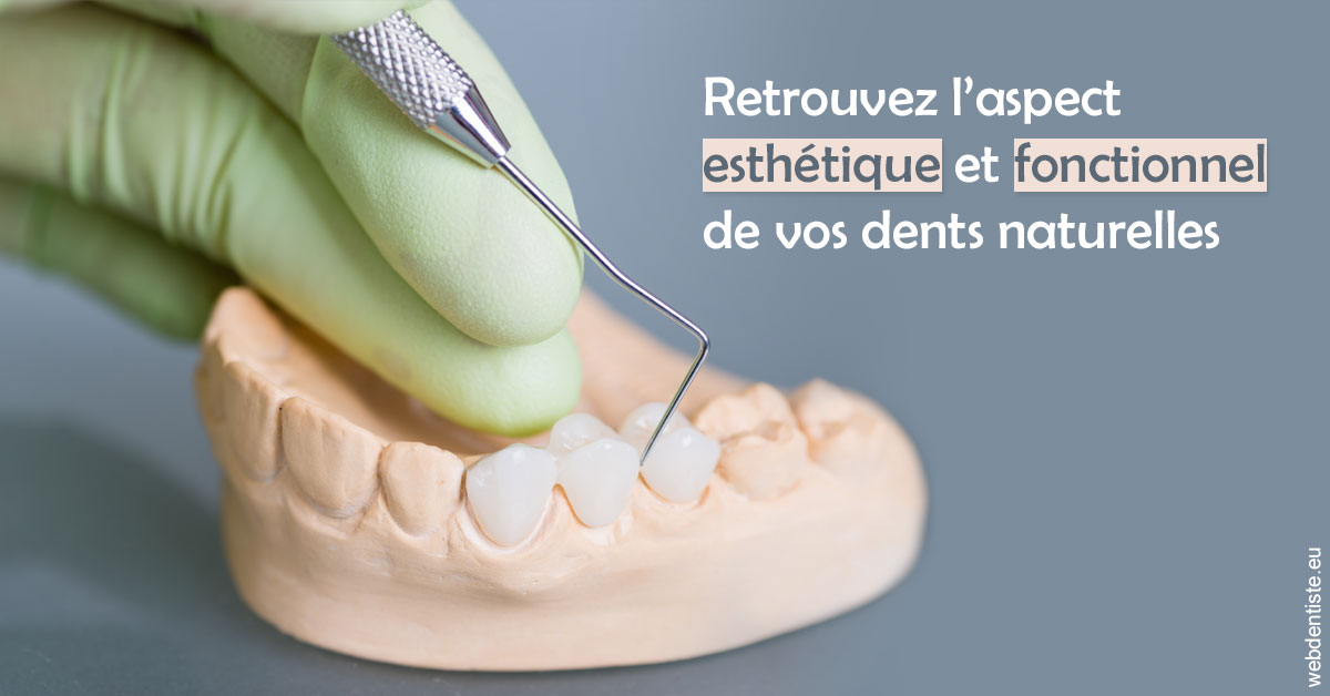 https://www.dr-necula.fr/Restaurations dentaires 1