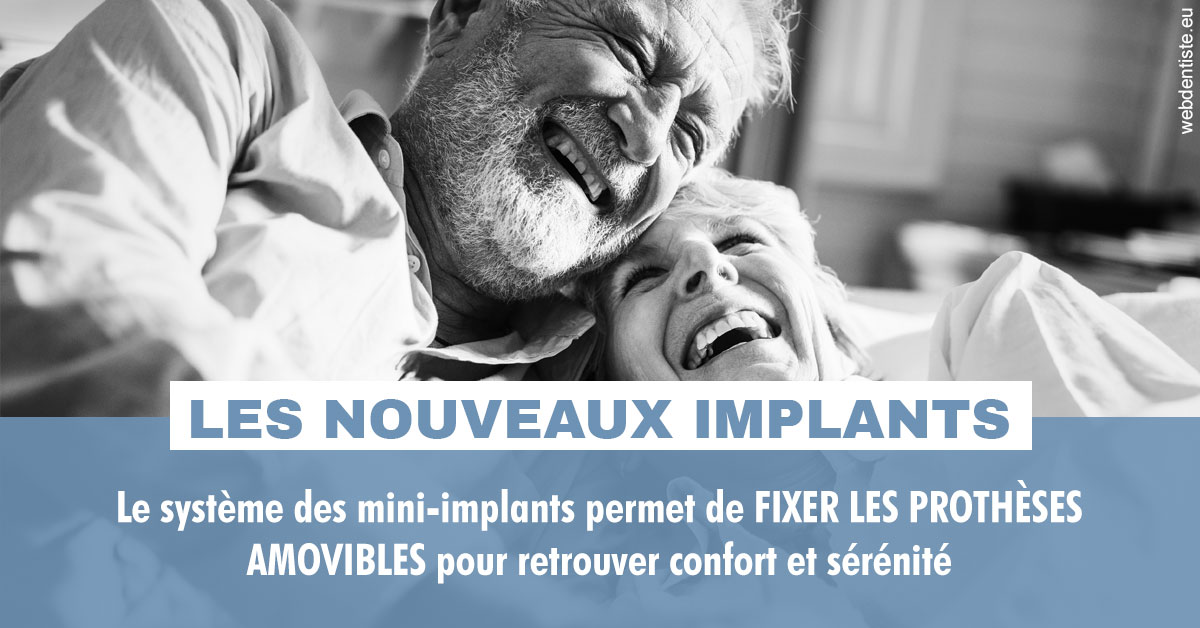 https://www.dr-necula.fr/Les nouveaux implants 2