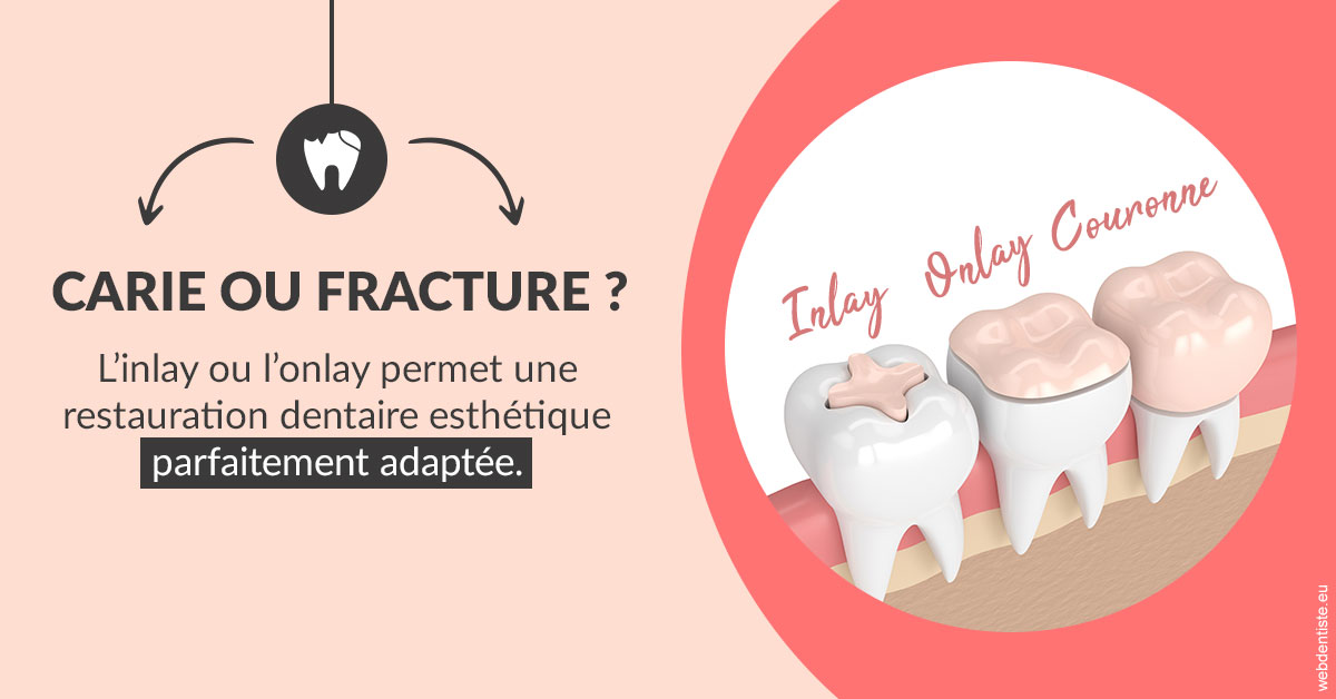 https://www.dr-necula.fr/T2 2023 - Carie ou fracture 2
