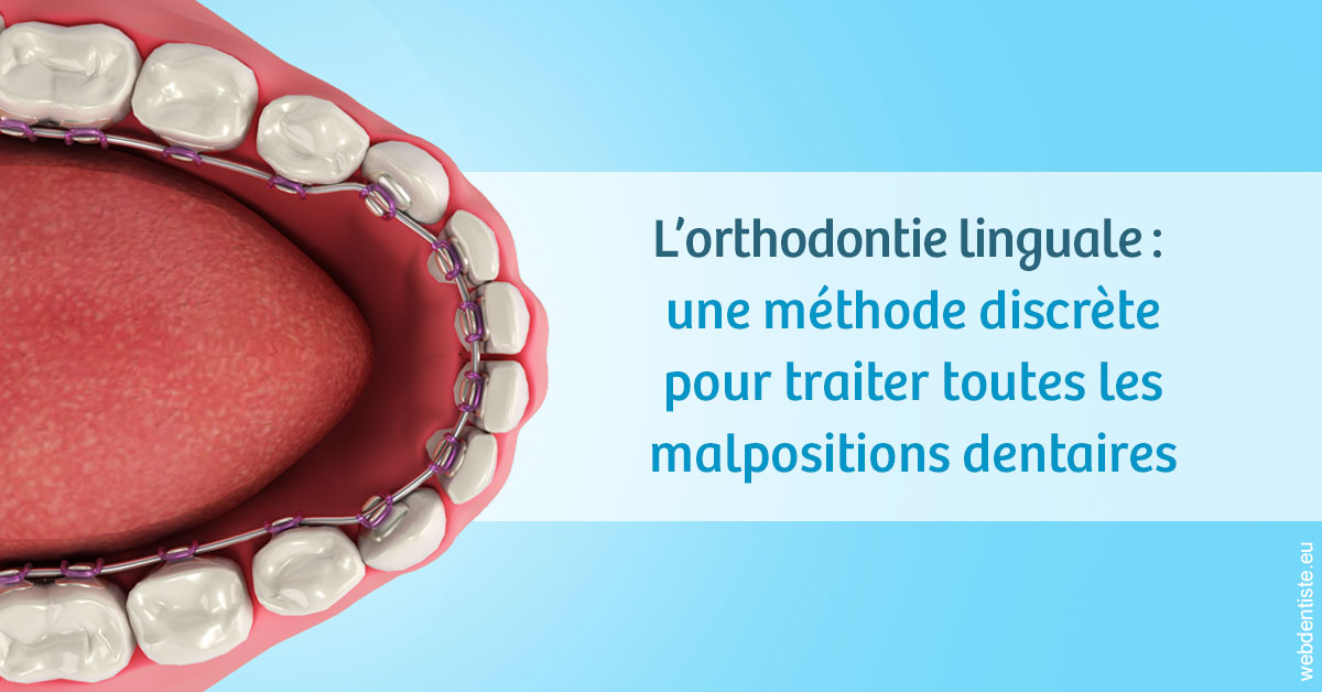 https://www.dr-necula.fr/L'orthodontie linguale 1