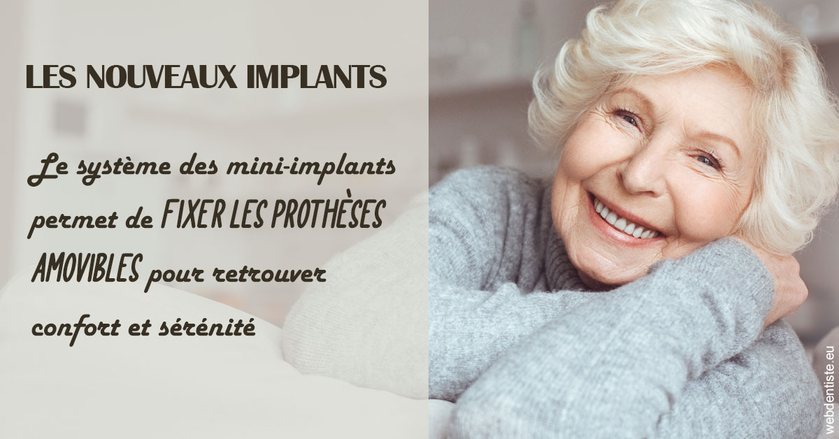 https://www.dr-necula.fr/Les nouveaux implants 1