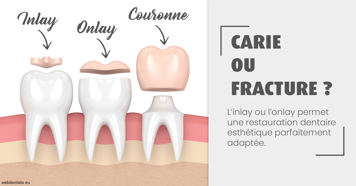 https://www.dr-necula.fr/T2 2023 - Carie ou fracture 1