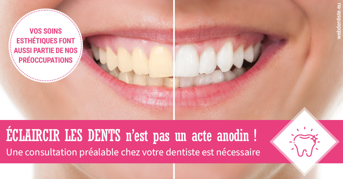 https://www.dr-necula.fr/2024 T1 - Eclaircir les dents 01