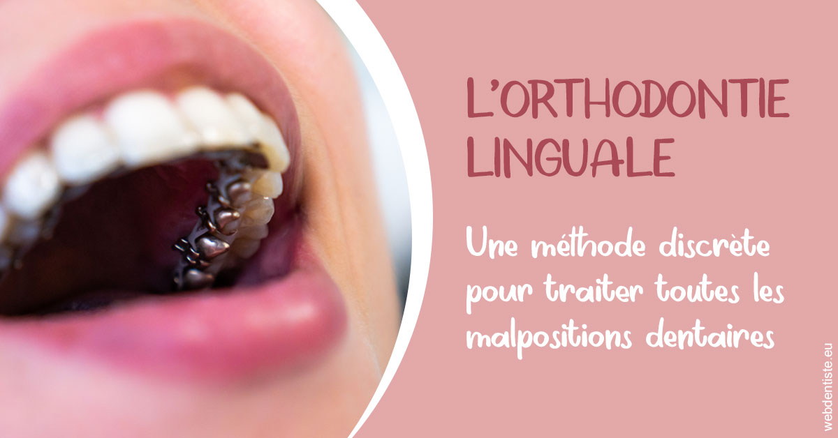 https://www.dr-necula.fr/L'orthodontie linguale 2