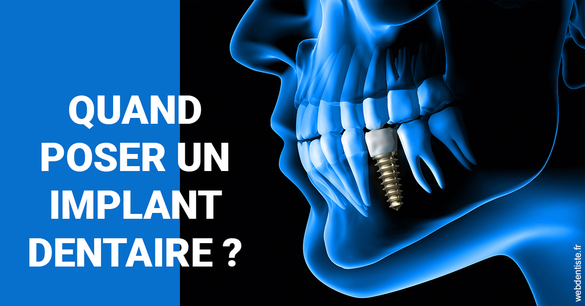 https://www.dr-necula.fr/Les implants 1