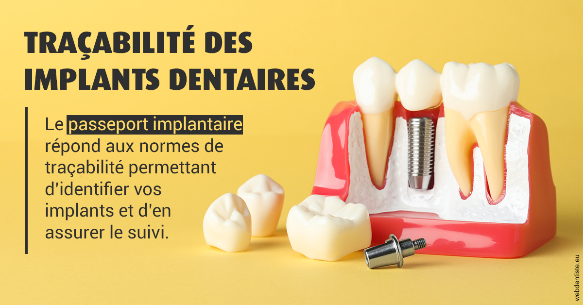 https://www.dr-necula.fr/T2 2023 - Traçabilité des implants 2