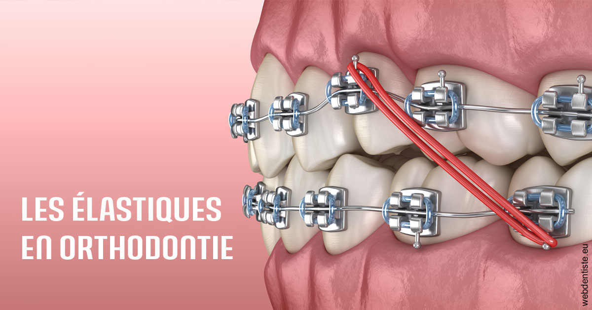 https://www.dr-necula.fr/Elastiques orthodontie 2