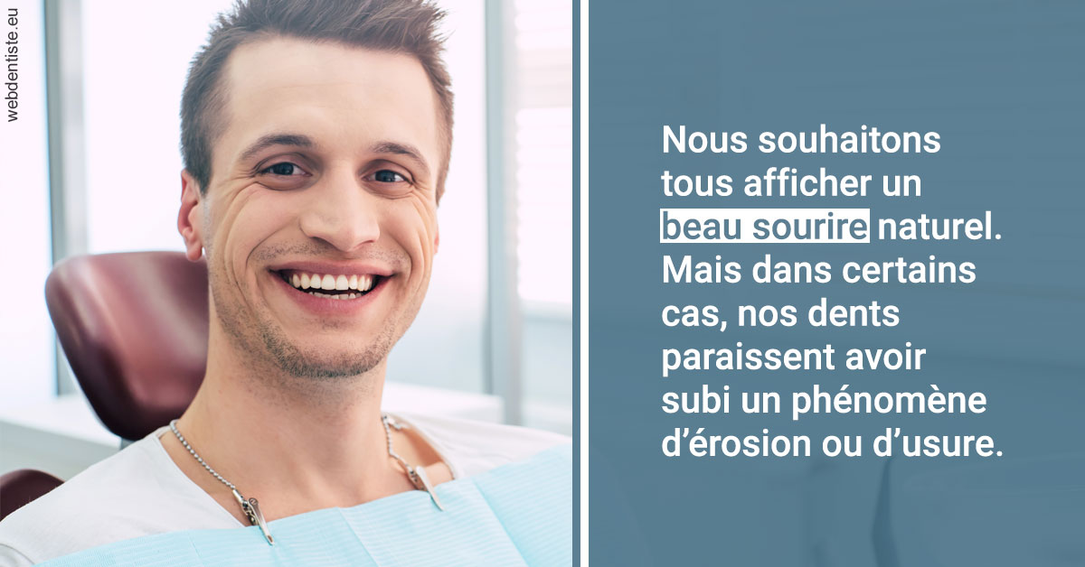 https://www.dr-necula.fr/Érosion et usure dentaire