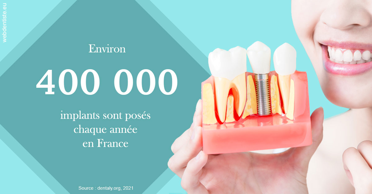 https://www.dr-necula.fr/Pose d'implants en France 2