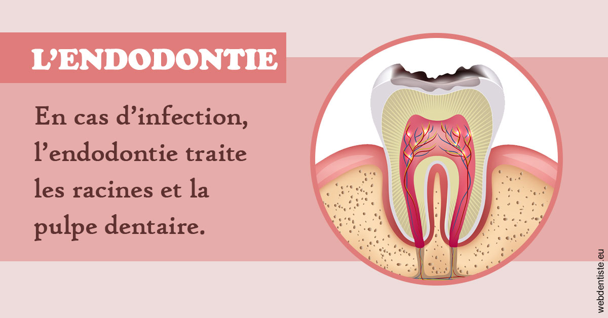 https://www.dr-necula.fr/L'endodontie 2