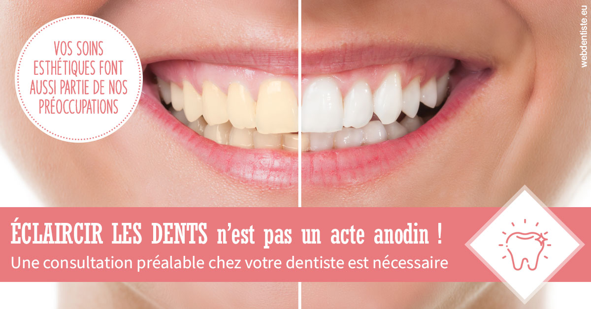 https://www.dr-necula.fr/Eclaircir les dents 1