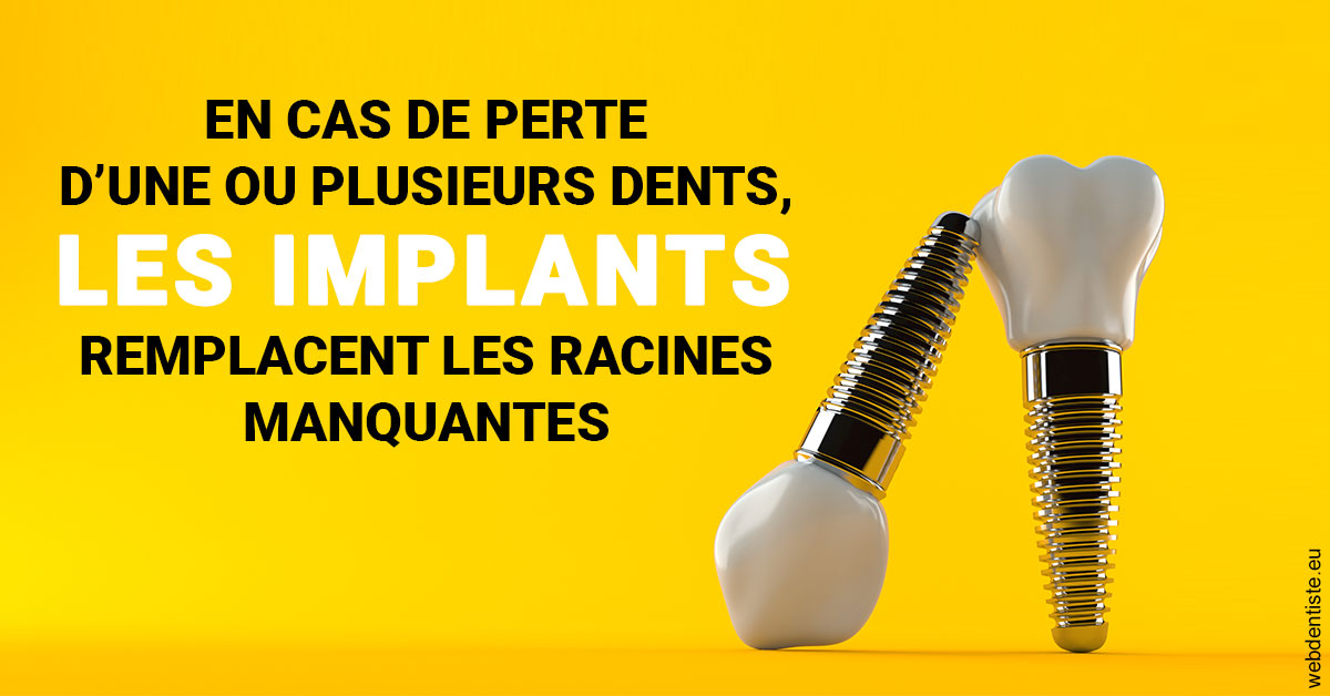 https://www.dr-necula.fr/Les implants 2